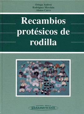 RECAMBIOS PROTESICOS DE RODILLA