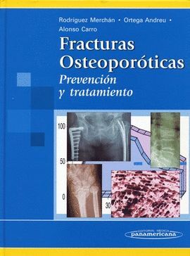 FRACTURAS OSTEOPOROTICAS